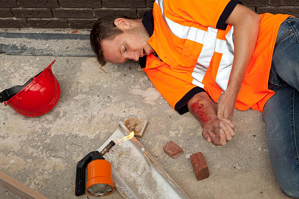 quemadura en el trabajo